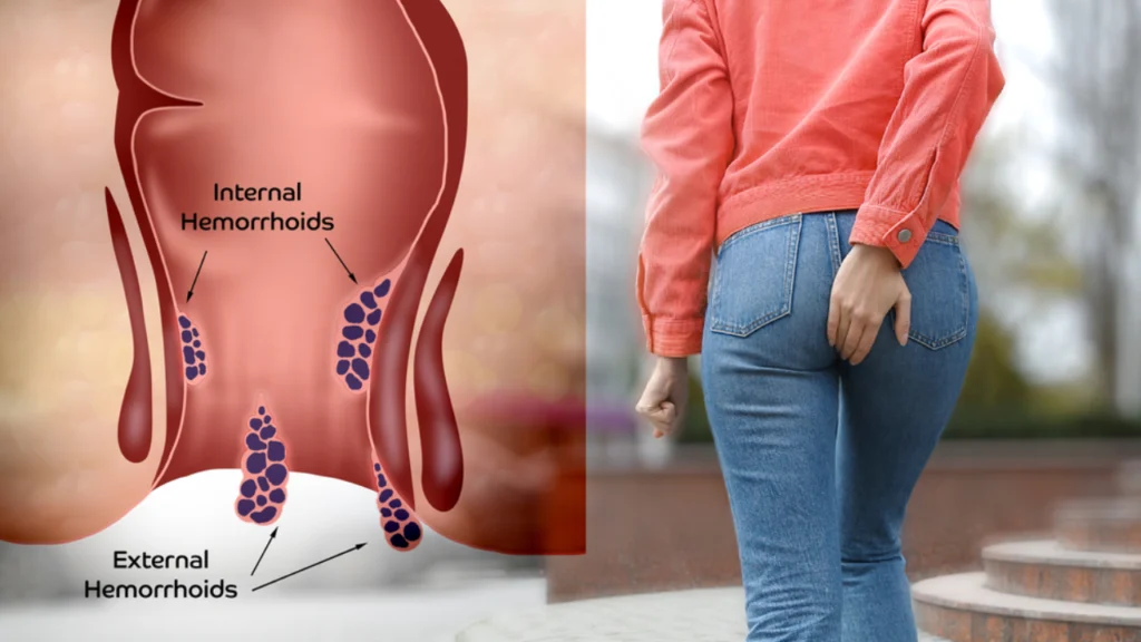 Top 7 Benefits of Ashwini Mudra for Body, Mind & Energy